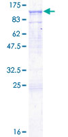 12.5% SDS-PAGE Stained with Coomassie Blue.